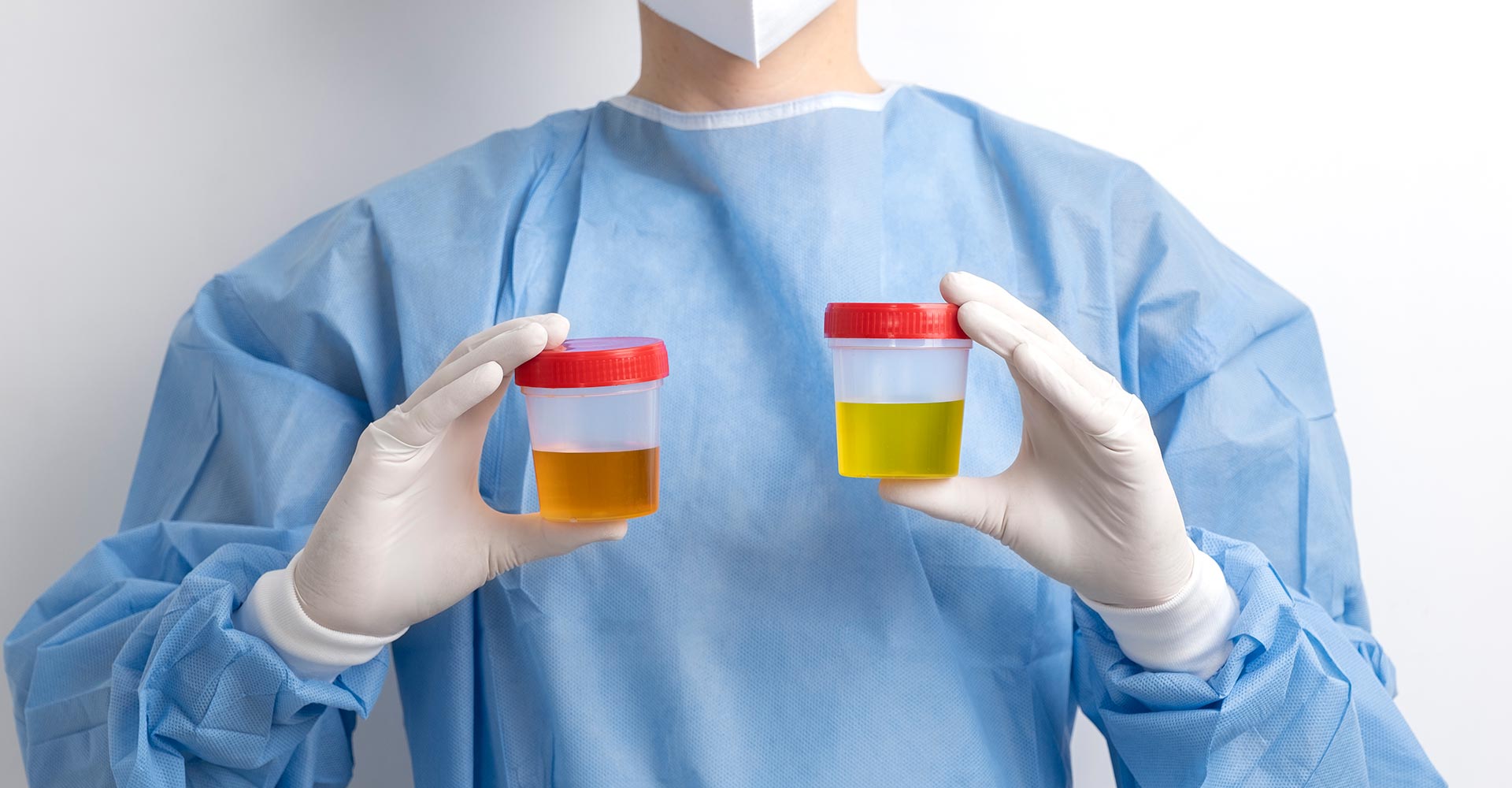 Uncomplicated Urinary Tract Infections (uUTI)